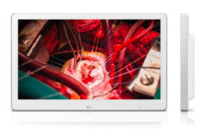 LG 27’’ Full HD: o monitor otimizado para cirurgias