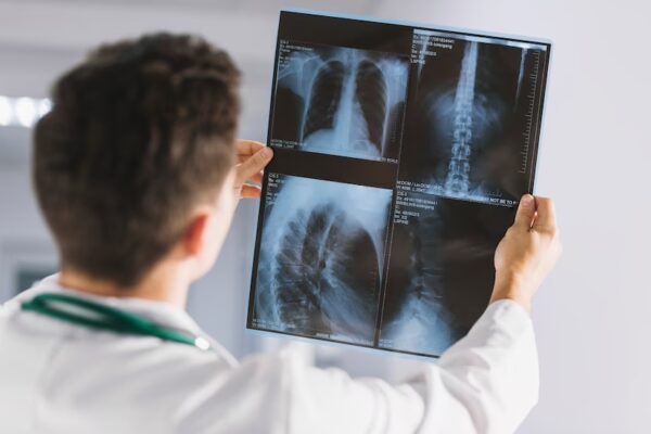 Exames de imagem: entenda a diferença entre tomografia e ressonância ...