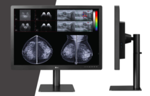 Diagnóstico para mamografia: confira os benefícios do monitor 31 polegadas 12 MP