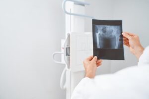 Saiba o que é e quais os benefícios da radiologia 4.0