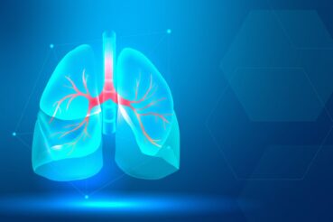 Vuno Med-Chest X-ray: a inovação para os diagnósticos de doenças pulmonares