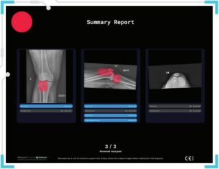 RBfracture: a transformação da radiologia por meio da IA