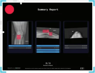 Revolução nas imagens médicas: como a IA está transformando a radiologia moderna