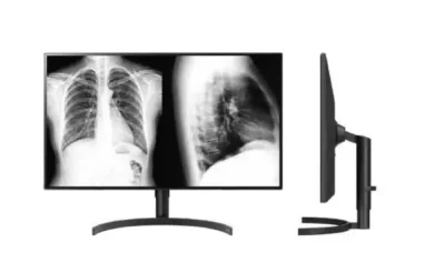 Saiba o que é e como os monitores diagnósticos atuam para a qualidade dos laudos