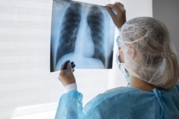Saiba o que é e o que muda com o uso do VUNO Med-Chest X-ray